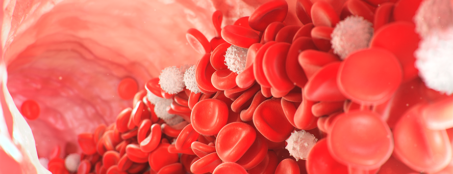 cardiosol